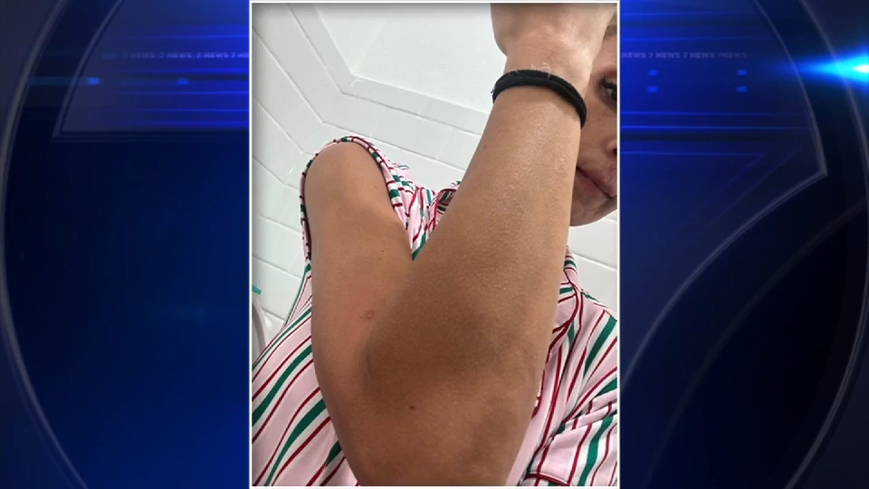 Jackson Memorial Hospital nurse sues hospital, county for $5 million after brutal attack by patient