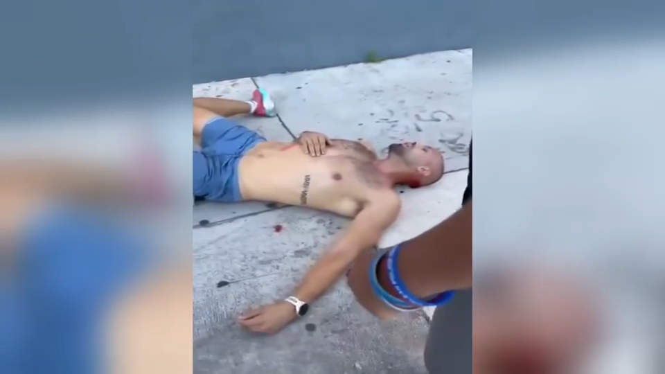 ‘I was all bit up:’ Video shows aftermath of random attack that left dog, owner with injuries in Wynwood
